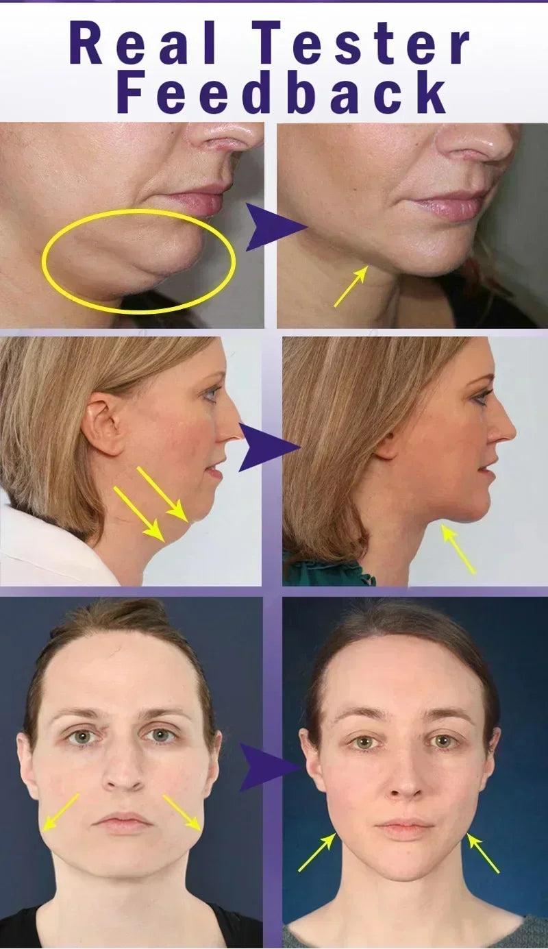 3RD  V-Shape Face Slimming Lifting Facial Cream Lift Up V Double Chin Cheek Slimming Firming Anti Wrinkle Beauty Skin Care