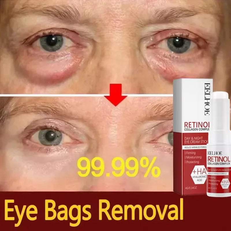 Fat Granules Removal Eyestick Anti-Puffiness Firming Cream Anti Inflammatory Fade Fine Line Repair Skin Barrier Korean Skin Care