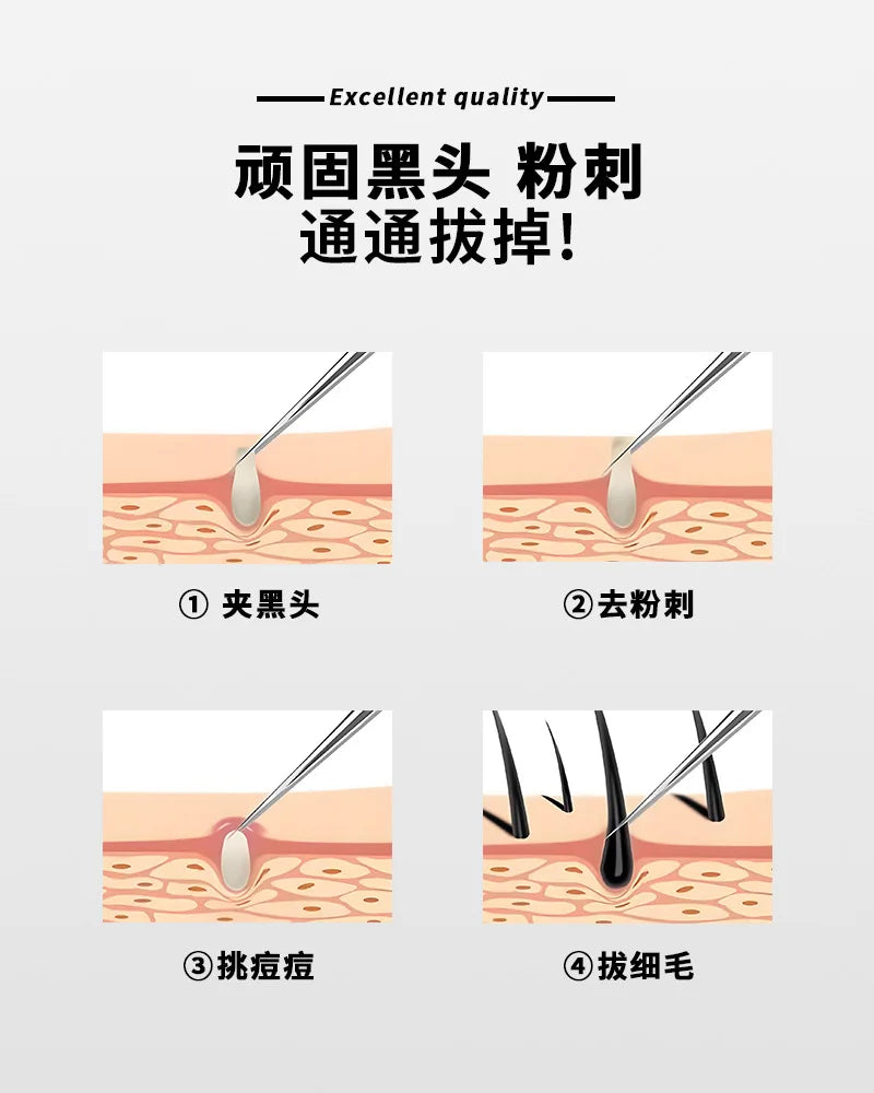 Acne Needle Blackhead Clip Remover Extraction Pore Black Head Clean Face Skin Care Cleansing Needle Blemish Removal Tool