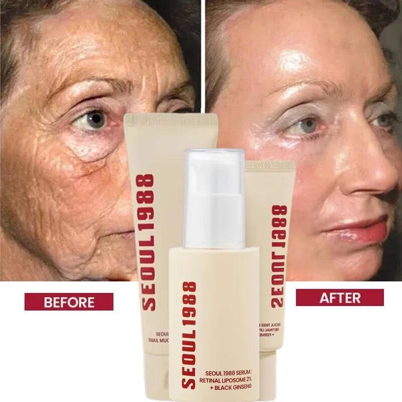 Korean 1988 Retinol Face Care Serum Black Ginseng Niacinamide 2% Acid Moisturizing Firming Cream Anti Aging Wrinkle Skin Care