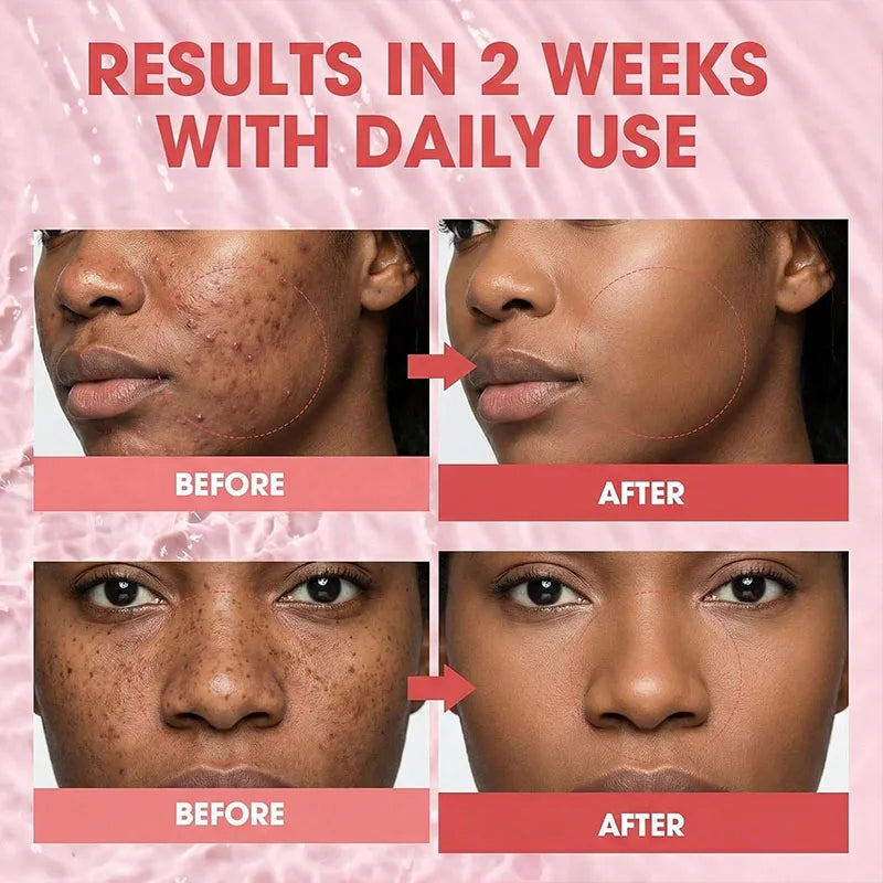 PDRN Serum Face Serum Skincare for Hydration Collagen Boost