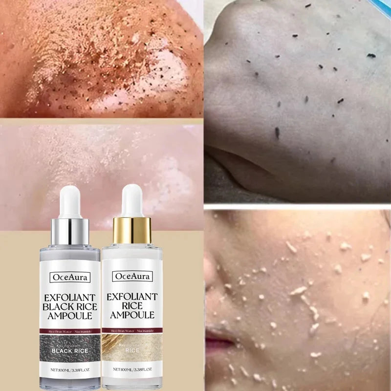 White Black Rice Exfoliating Serum Peel Shot Facial Moisturizing Soften Blackhead Removal Hydrating Shrink Pores Skin Care Korea