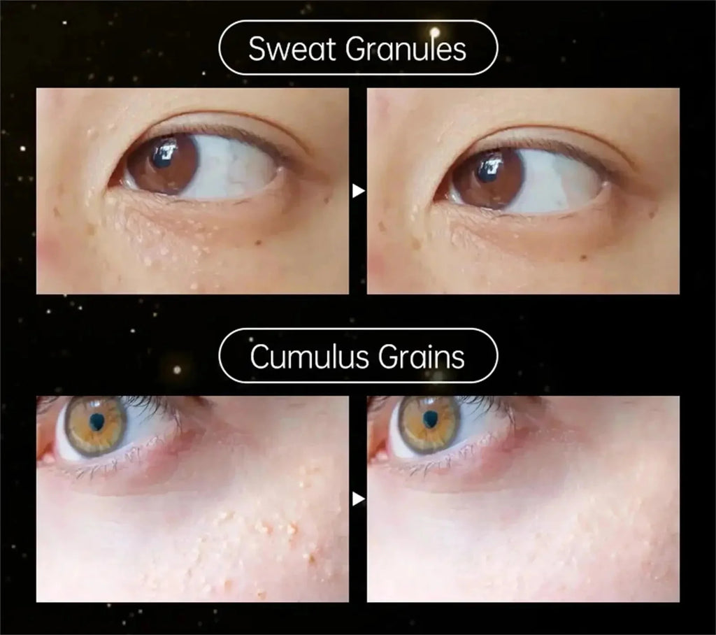 Fat Granules Removal Eyestick Anti-Puffiness Firming Cream Anti Inflammatory Fade Fine Line Repair Skin Barrier Korean Skin Care