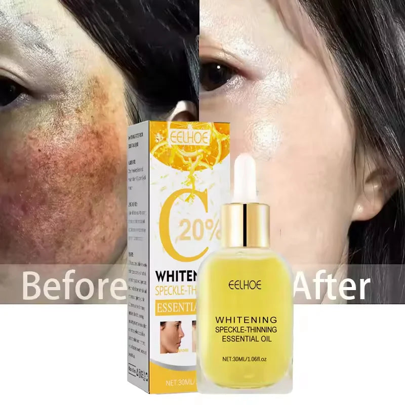 Whitening Freckle Serum Melanin Correcting Fade Pigment Remove Melasma Moisturizing Dark Spot Brighten Beauty Skin Care Essence