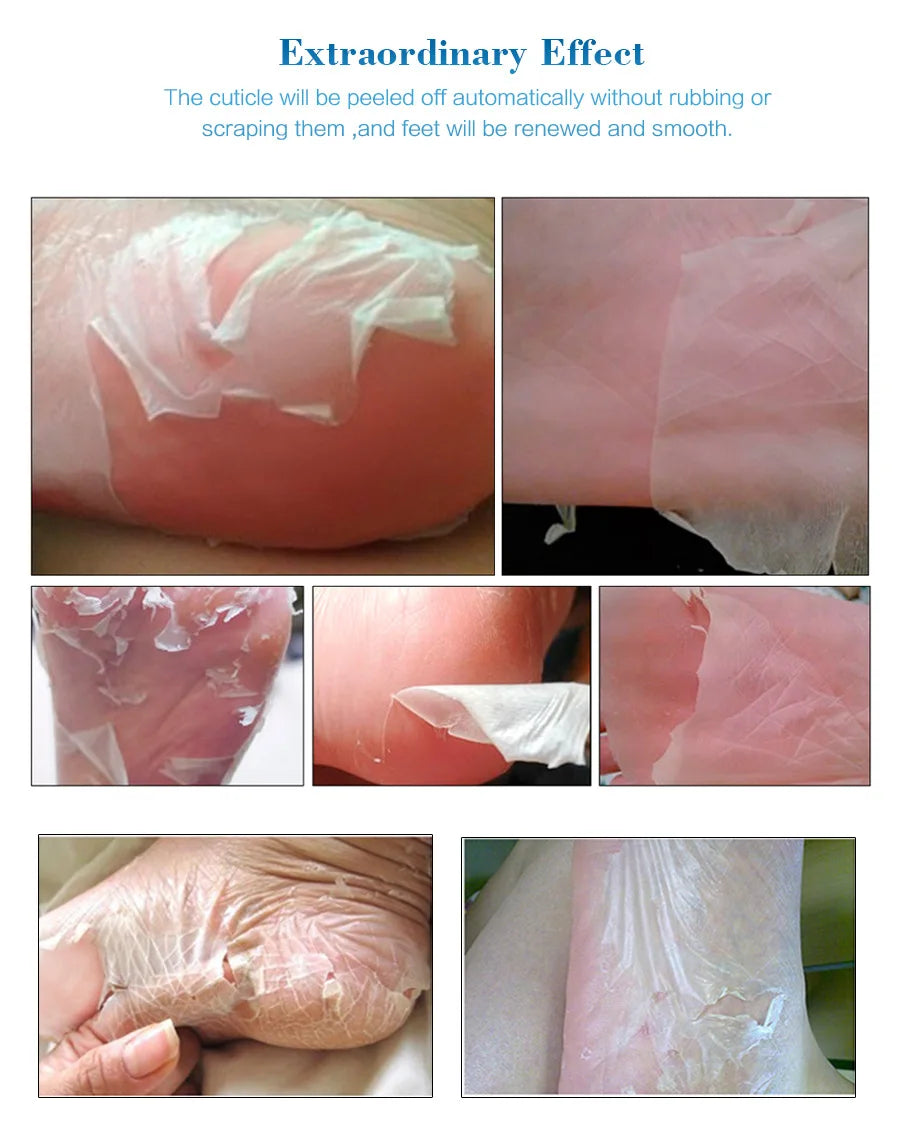 1-10Pcs Exfoliating Foot Mask Foot Spa Pedicure Socks Removing Dead Skin Whitening Heels Peeling Anti Cracked Foot Skin Care