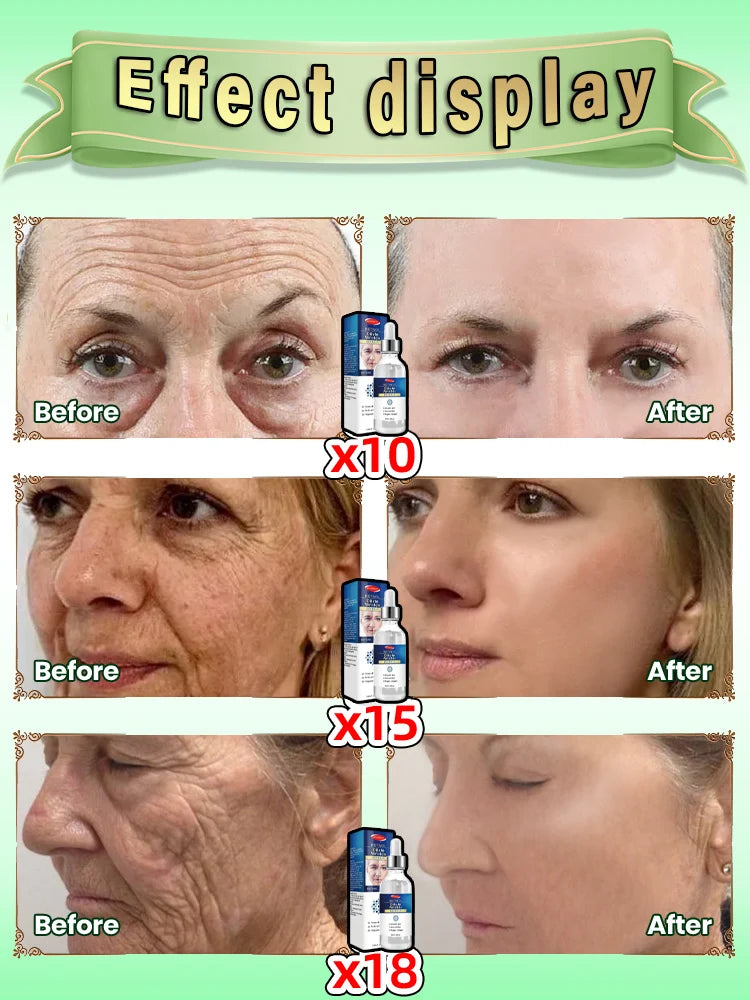 Anti-wrinkle facial essence anti-aging anti-wrinkle essence brightening and firming whitening moisturizing skin care
