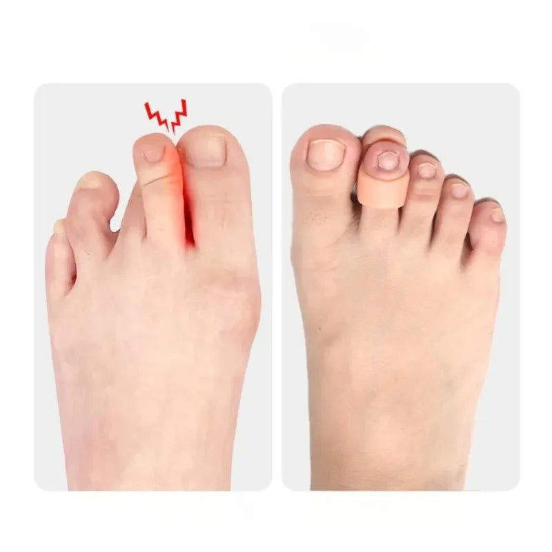 2/4PCS Hammer Toe Corrector Hammertoe Straightener for Curled Crooked Bent Claw and Overlapping Toes Bunion Pads Foot Care Tools