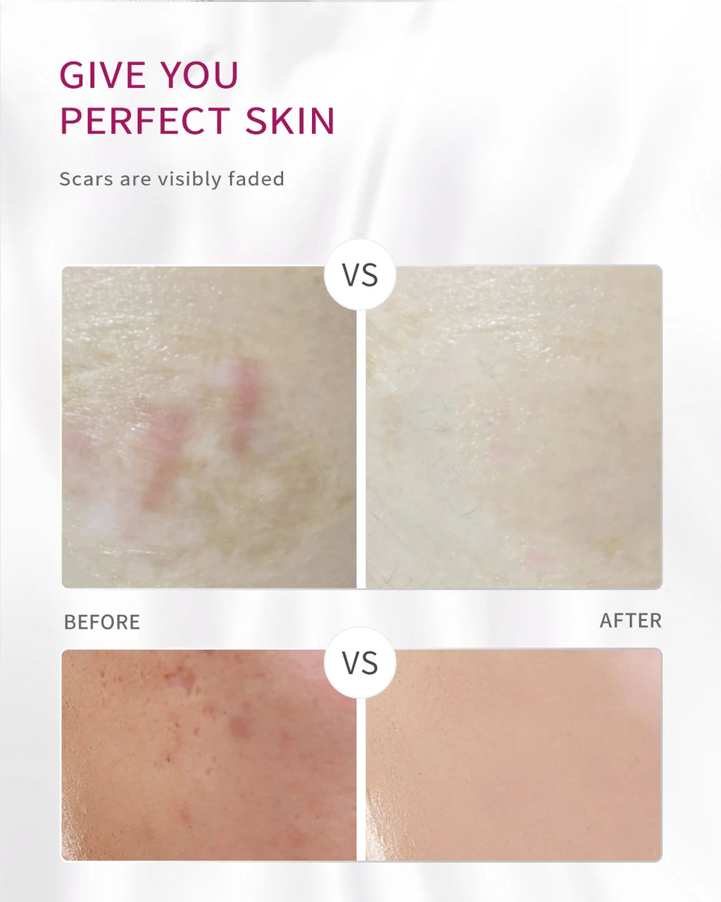 RtopR Mango Skin Cream Whitening and Moisturizing Skin Rejuvenation Nourishing Skin Care