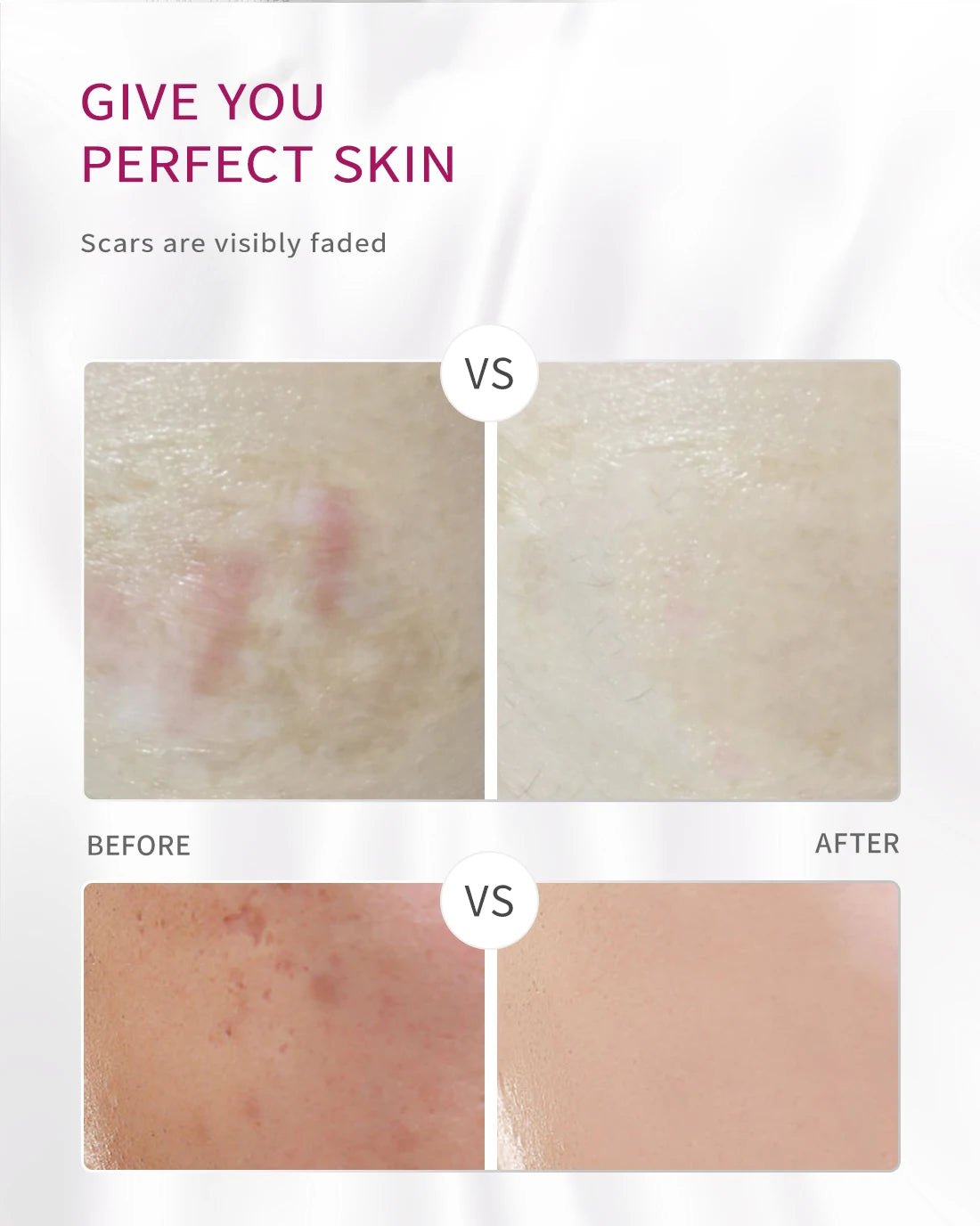 RtopR Mango Skin Cream Whitening and Moisturizing Skin Rejuvenation Nourishing Skin Care