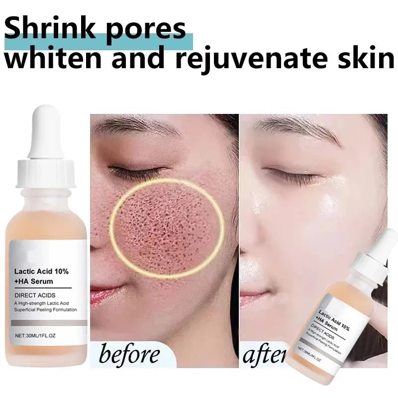 Remove Large Pores Serum Lactic Acid Facial Pore Shrinking Repairing Products Pore Minimizing Firming Smooth Korean Skin Care