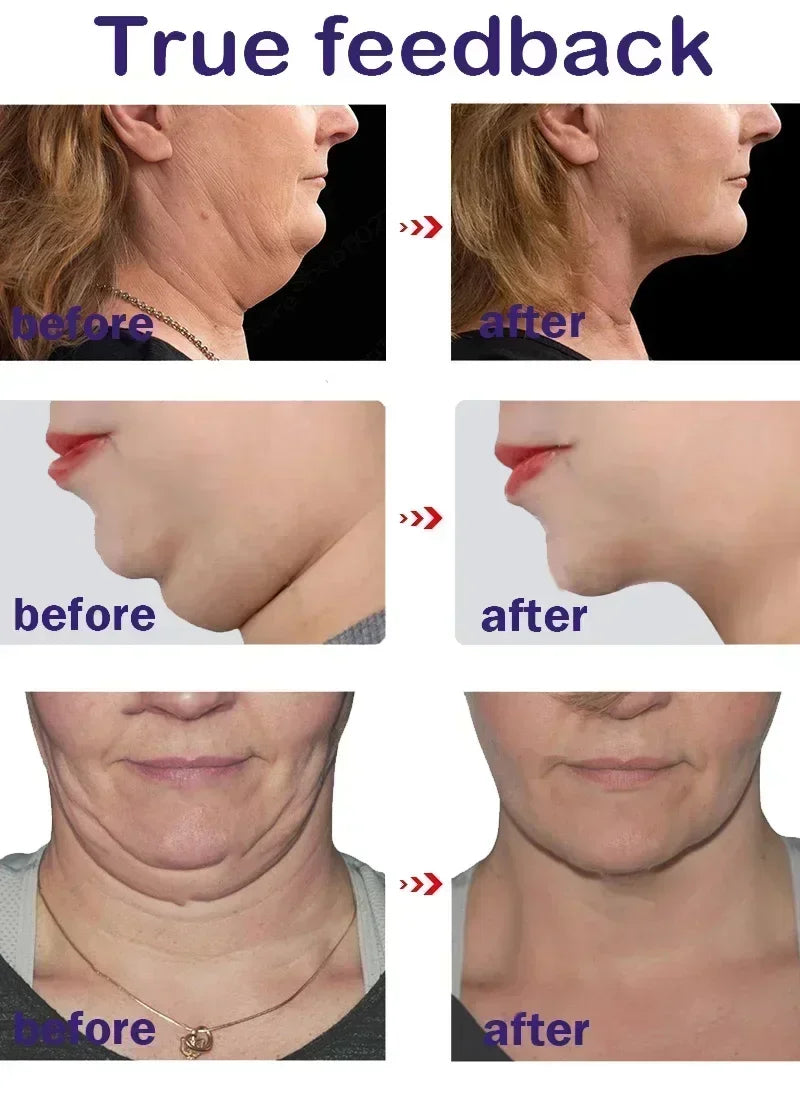 3RD  V-Shape Face Slimming Lifting Facial Cream Lift Up V Double Chin Cheek Slimming Firming Anti Wrinkle Beauty Skin Care
