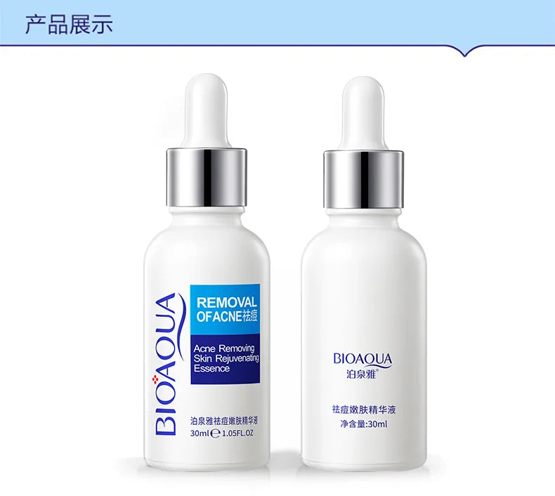 Treatment Cream Face Acne Remover Repair Gel Oil Control Serum Shrink Pores Whitening Facial mask Skin Care Korean Cosmetic