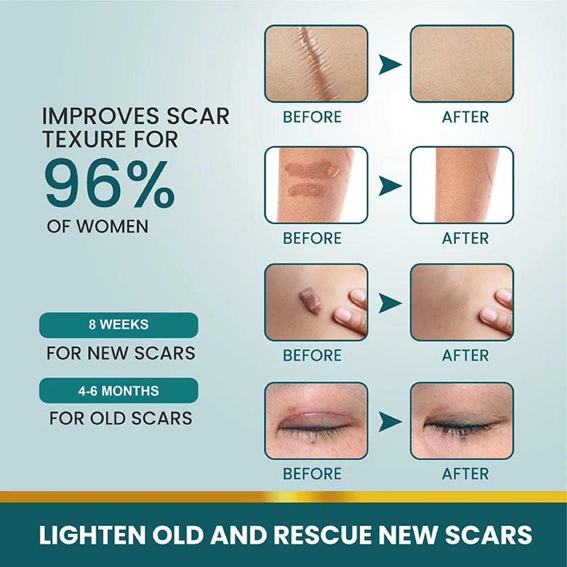 New 1 Roll Silicone Scar Sheets Gel Scar Patch 4cmX150cm Self-Adhesive Scar Cover Tape Reusable And Effective Skin Care Strips