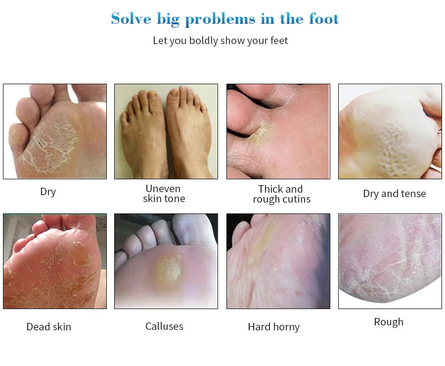 1-10Pcs Exfoliating Foot Mask Foot Spa Pedicure Socks Removing Dead Skin Whitening Heels Peeling Anti Cracked Foot Skin Care