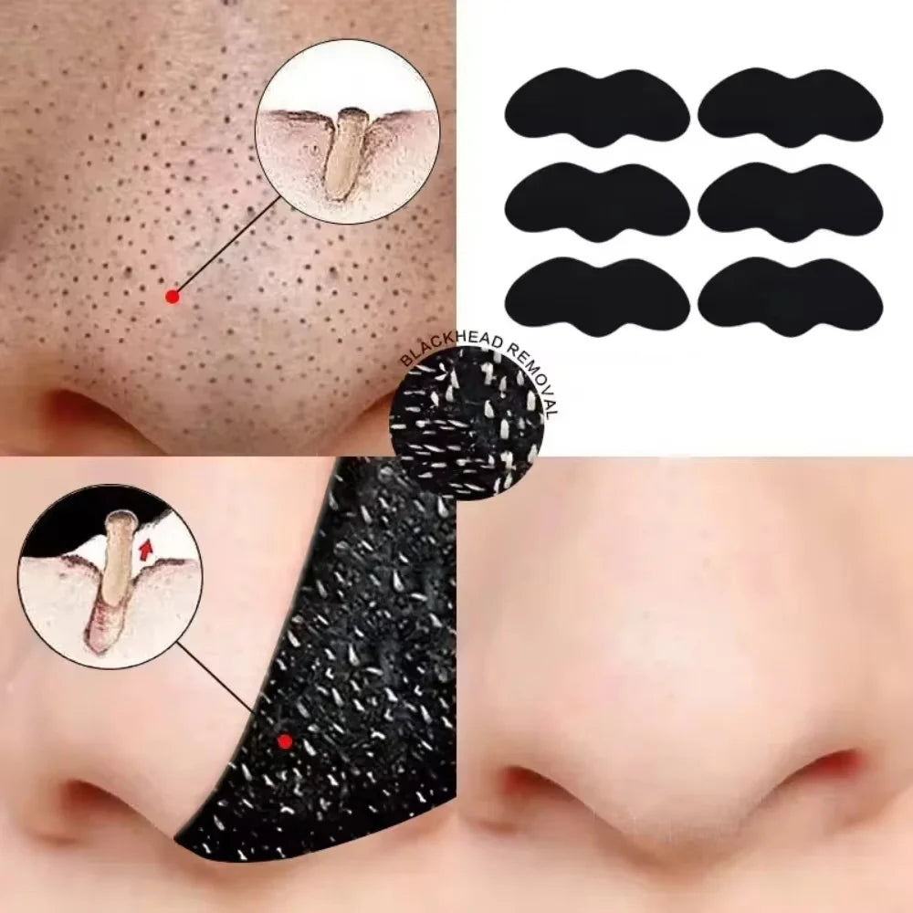 10/20/50/100PCS Nose Blackhead Remover Mask Shrink Pore Acne Treatment Sticker Black Dots Strips Nose Deep Cleansing Skin Care