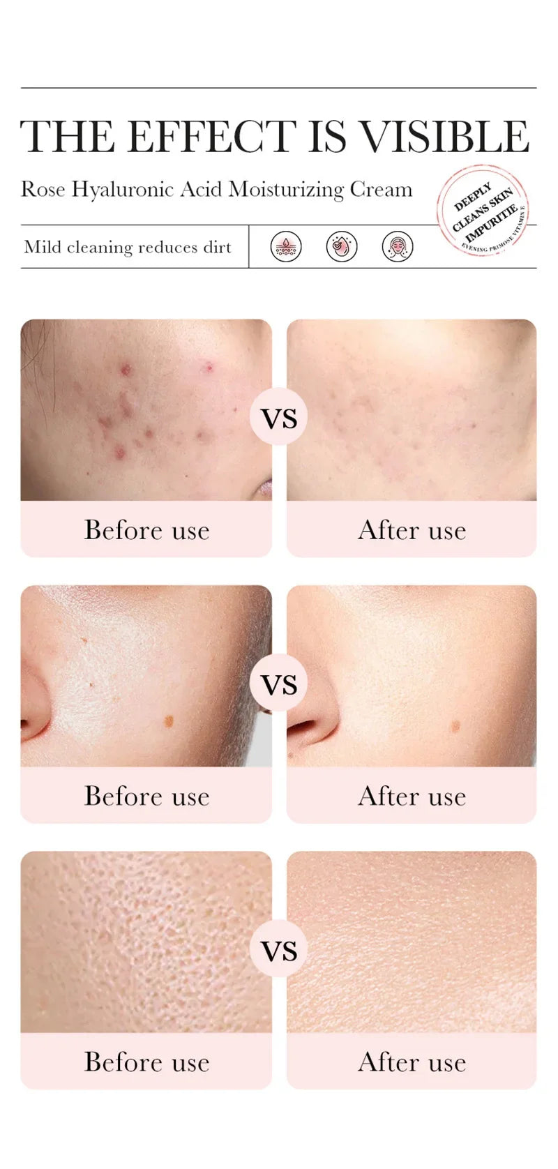 BIOAOUA Hyaluronic Acid Rose Essence Cream Shrink Pores Anti-oxidation Lock Water Hydrating Moisturizing Face Cream Skin Care