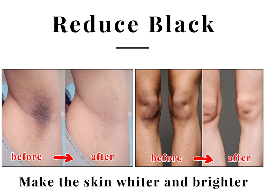Kojic Acid Glow Soap Facial Deep Cleaning Even Skin Tone Skin Lightening Soap Oil Control Moisturizing Skin Care Soap for Men
