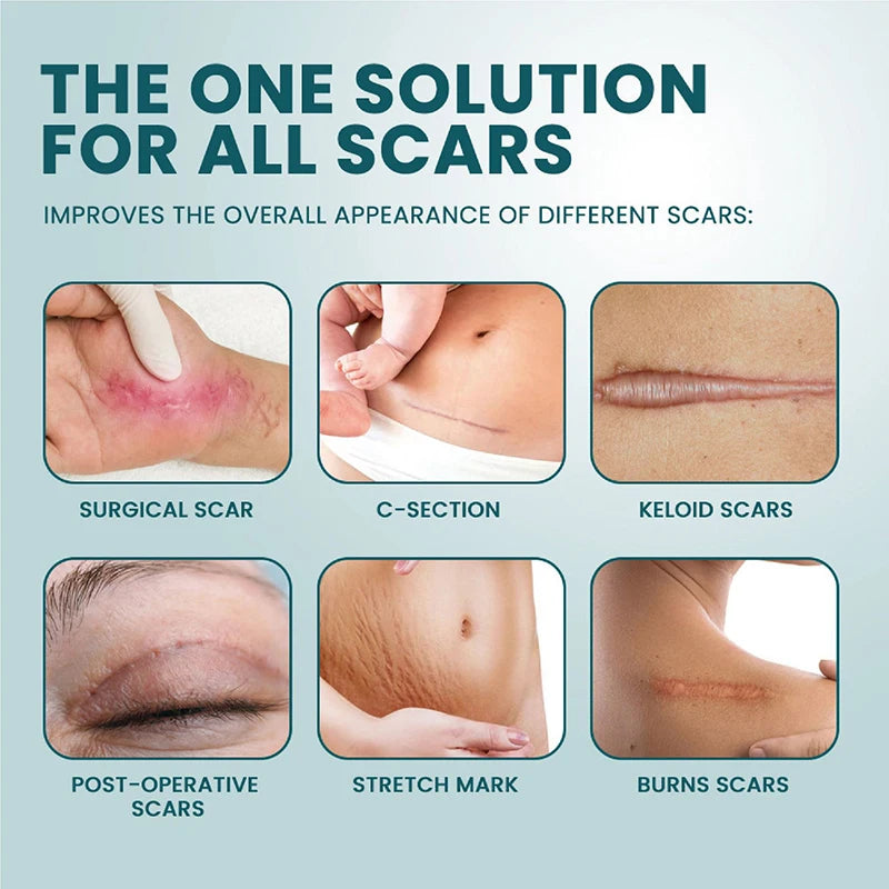 New 1 Roll Silicone Scar Sheets Gel Scar Patch 4cmX150cm Self-Adhesive Scar Cover Tape Reusable And Effective Skin Care Strips