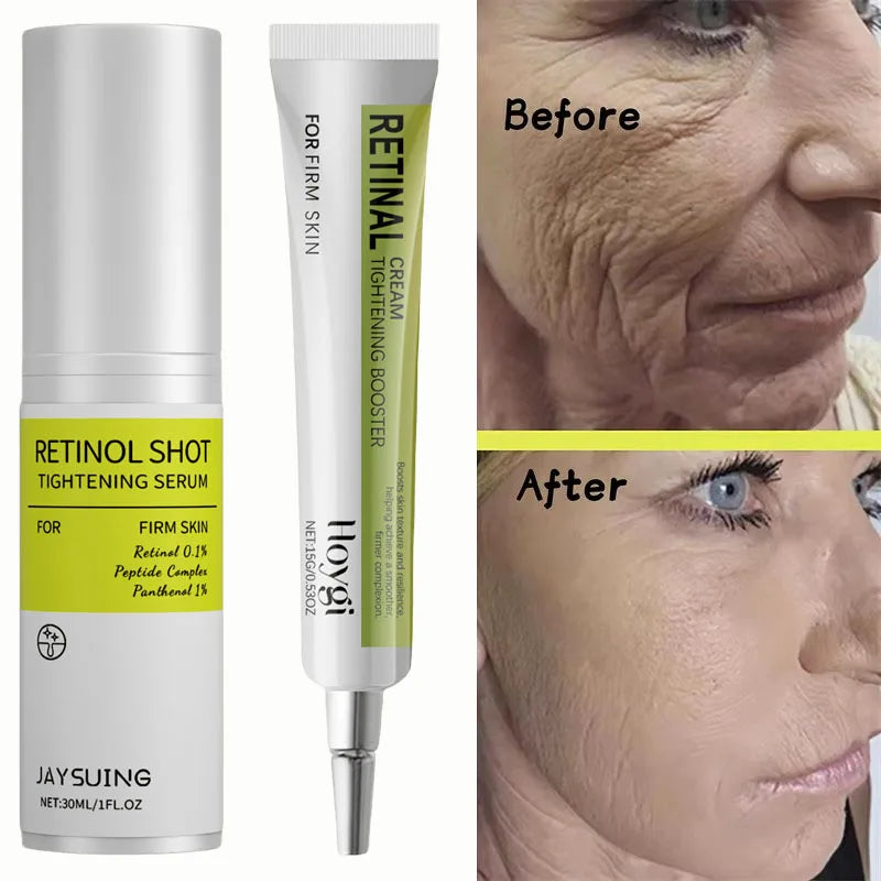 Retinol Wrinkle Remover Cream Shot Tightening Firming Fine Line Enhancer Moisturizing Pore Shrinking Repair Serum Skin Care Set