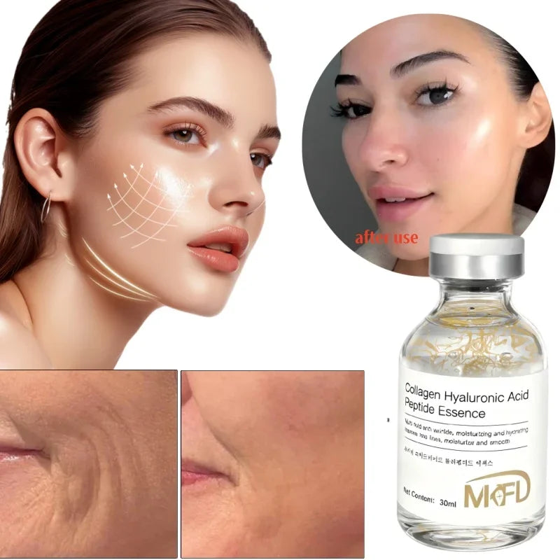 Korean Collagen Silk Peptide Hydrating Ampoule Serum, Intensive Lifting & Elasticity Boost Skin Care for Dry & Dull Skin