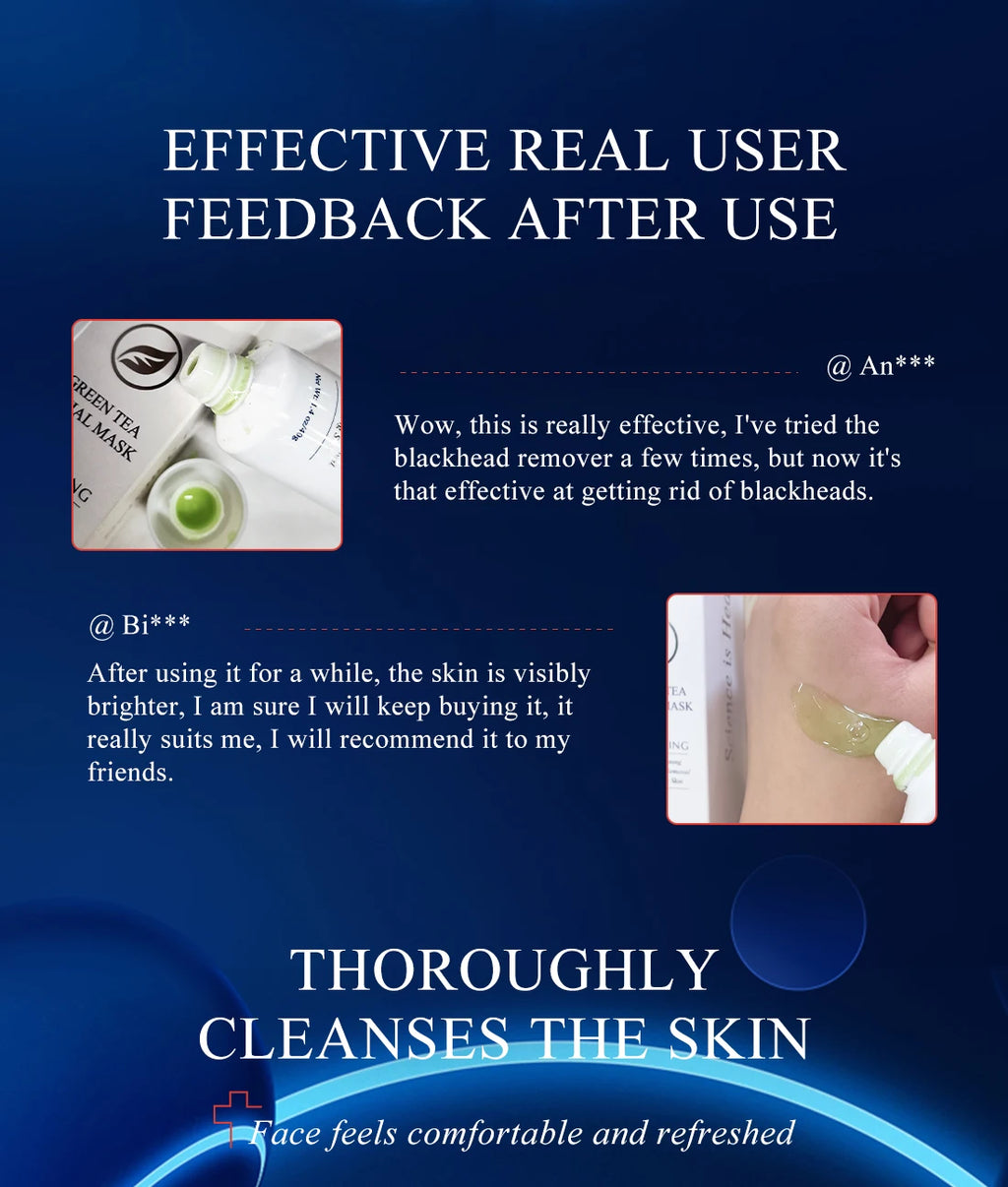 Green Tea Whitehead Oil Control Mask Deep Pore Cleansing Dirt Removes Whiteheads Skin Care Smooth Skin Whitening Moisturizing