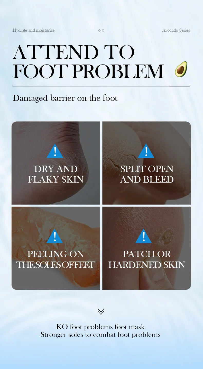 1/3/5 Pairs Avocado Exfoliating Foot Mask Feet Pedicure Remove Dead Skin Moisturizing Foot Exfoliator Feet Masks Skin Care
