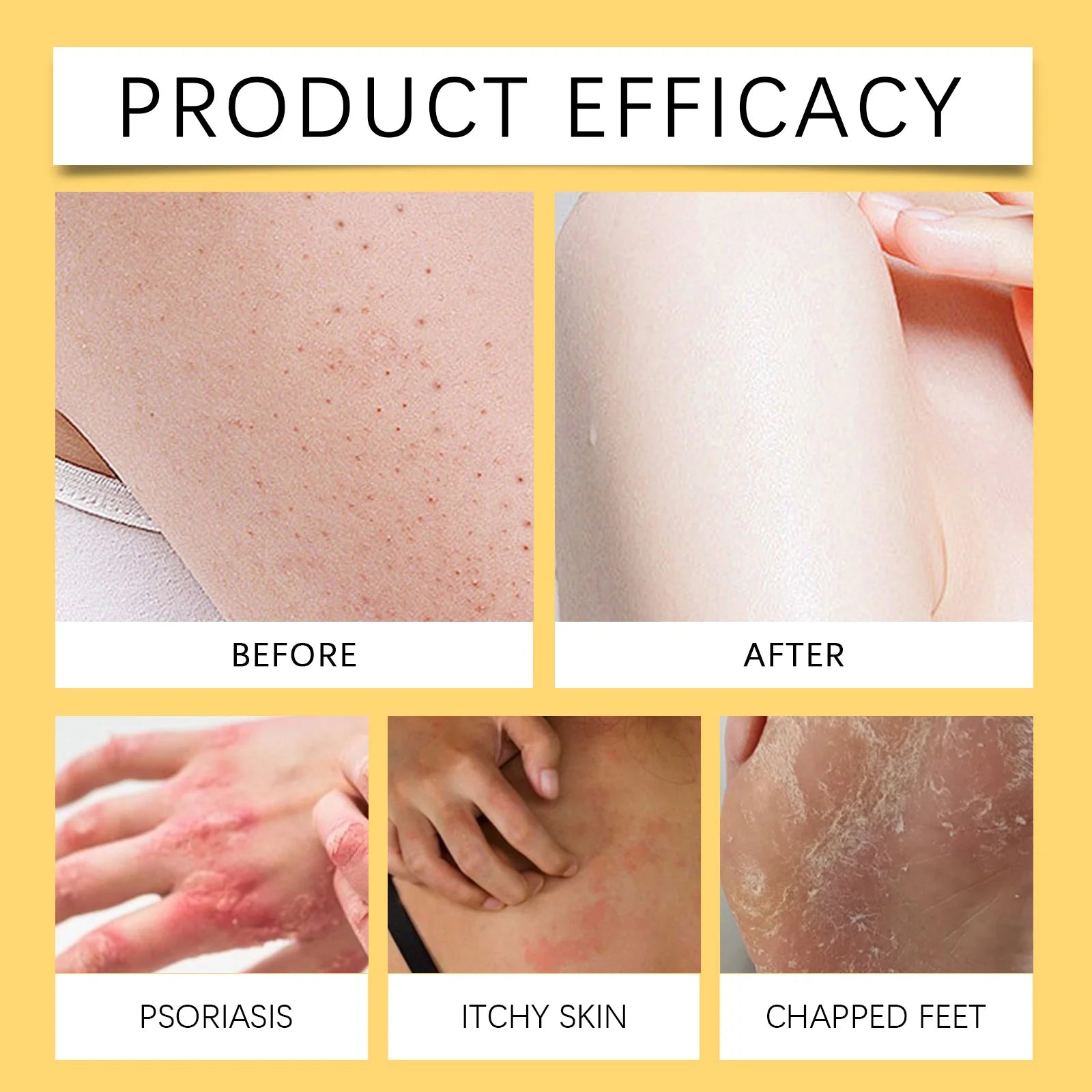 Bee Venom Skin Care Cream-Moisturizing Nourishing Lotion, Relieves Dryness Soothes Redness, Strengthens Barrier & Youthful Look