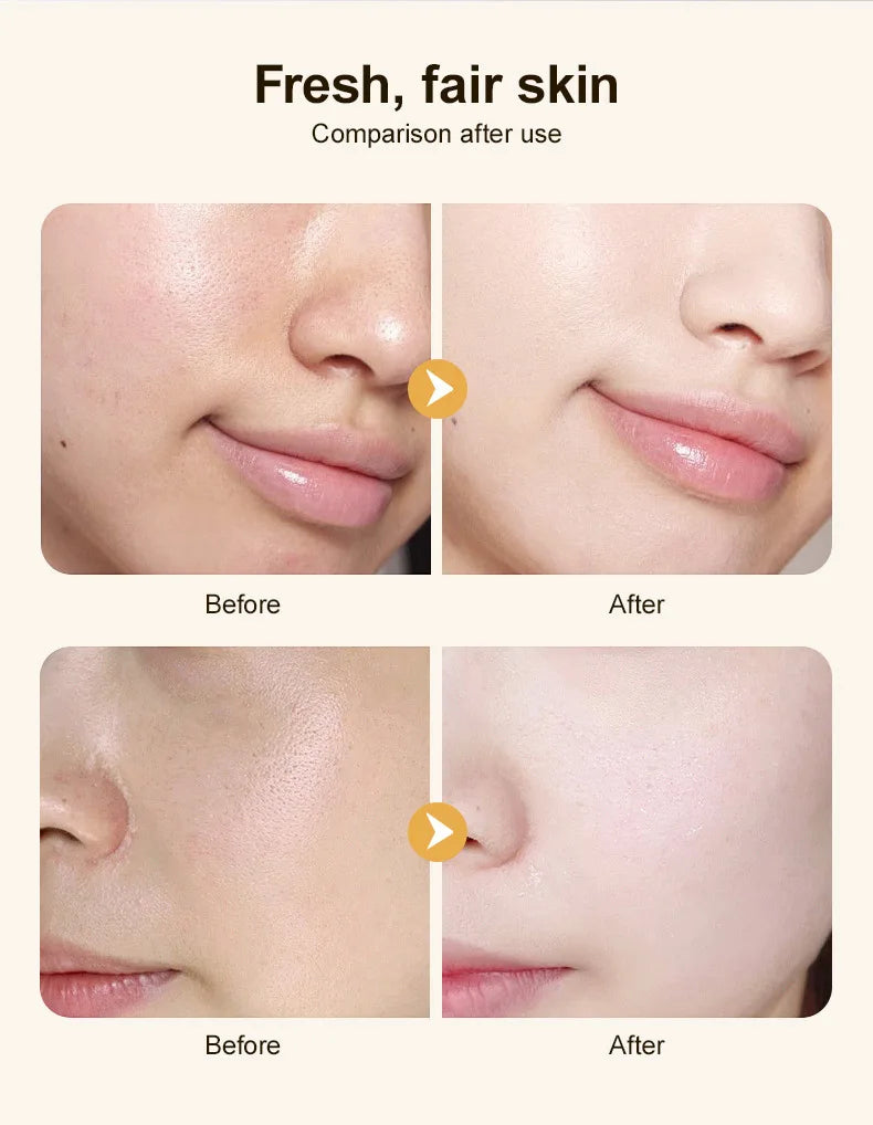 Madagascar Centella Asiatica Glow Essence Moisturizing Niacinamide Effective for Skin Care Pore Care for Sensitive Skin Ampoule
