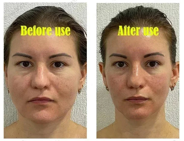 3RD  V-Shape Face Slimming Lifting Facial Cream Lift Up V Double Chin Cheek Slimming Firming Anti Wrinkle Beauty Skin Care