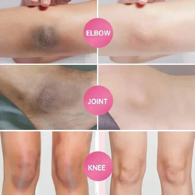 Whitening Cream Private Parts Underarm Bleaching Serum Whiten Butt Knee Brighten Inner Thigh Intimate Parts Dark Remove Melanin
