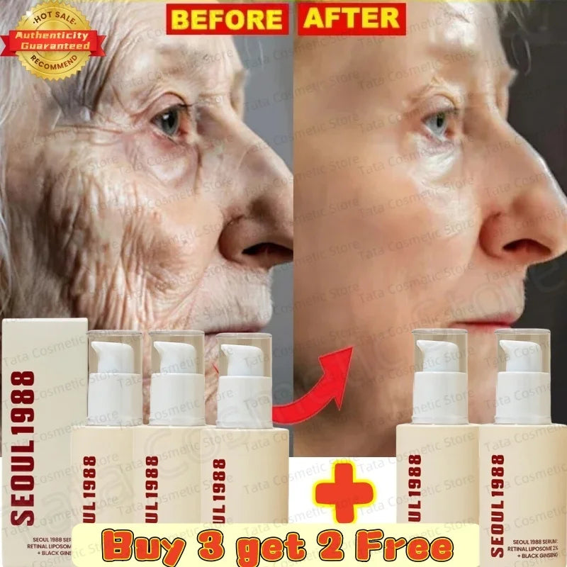 Korean SEOUL 1988 Serum Black Ginseng 2%Retinal Anti Aging Wrinkle Firming Pores Brightening Nicotinamide Balancing Skin Care