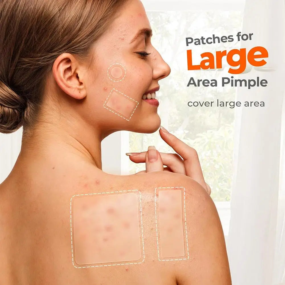 Acne Pimple Patch Invisible Waterproof Absorb Pus Acne Pimple Remover Tool Acne Cleaner Korean Skin Care Product