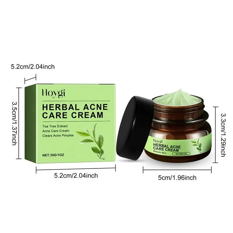 Natural Herbs Acid Acne Cream Shrink Pores Blackheads Scars Acne Marks Blemishes Oil Control Whitening Korean Skin Care Products