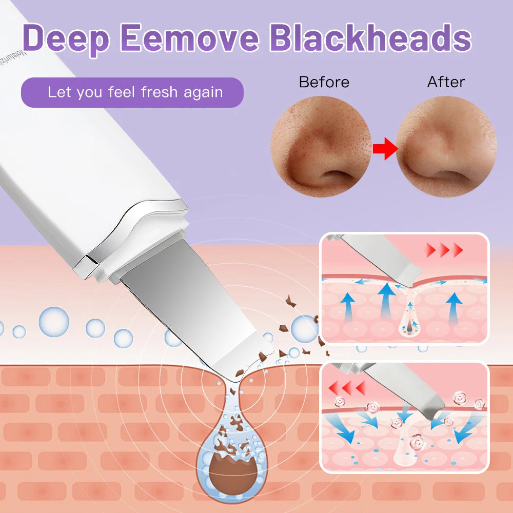 Facial Skin Scrubber Face Spatula Exfoliator Deep Cleansing Blackhead Remover Facial Lifting Cleaning Not Ultrasonic Skin Care