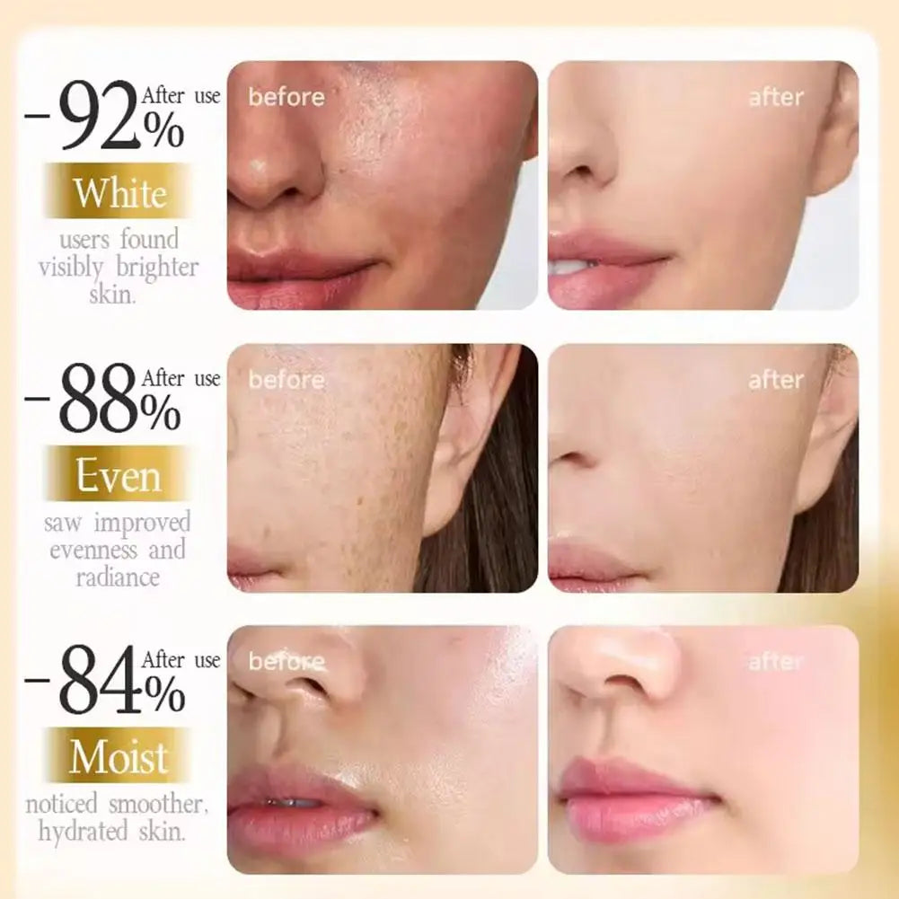 PDRN Face Cream Salmon DNA Skin Regeneration Anti Wrinkle Lifting Firming Whitening Brightening Moisturizer Korean Skin Care 20g