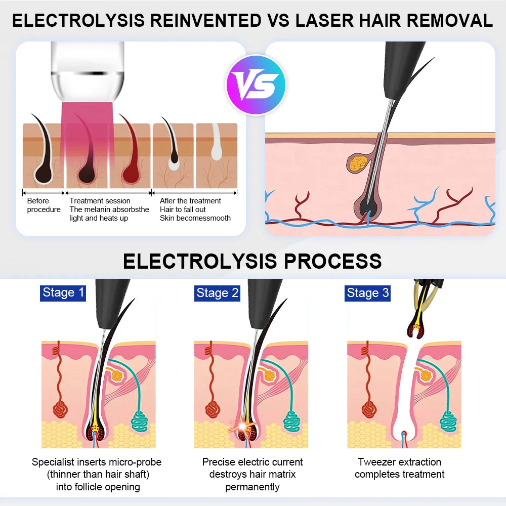 Professional Permanent Electrolysis Hair Removal Machine Painless Needle Epilation